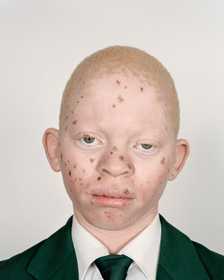 Mirando a un lado — Pieter Hugo, 2006