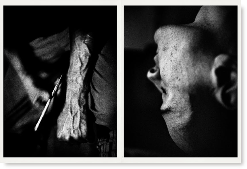 SELF-PORTRAITS 1987–2017, Antoine d’Agata, SUPER LABO, 2017